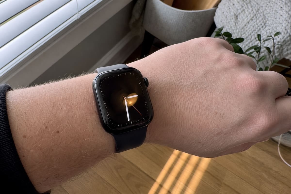 Customer photo — Apple Watch Series 11